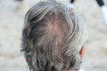 What causes grey hair?